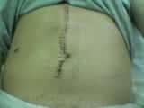 Phil’s stomach is all owchie (clicky)